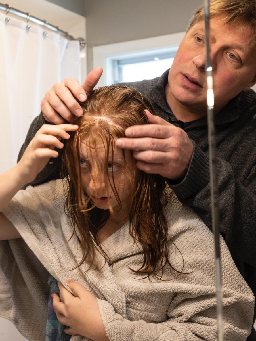 A reflection in a bathroom mirror shows us a daughter and father pointing at the girl’s wet hair and scalp.